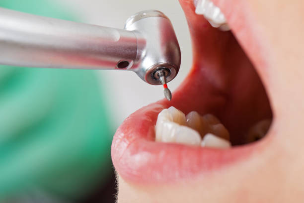 Best Root Canal Emergency Dentist  in Oak Valley, NJ